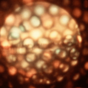 Everything Turns… by Aaron Zeghers&nbsp;(CAN)